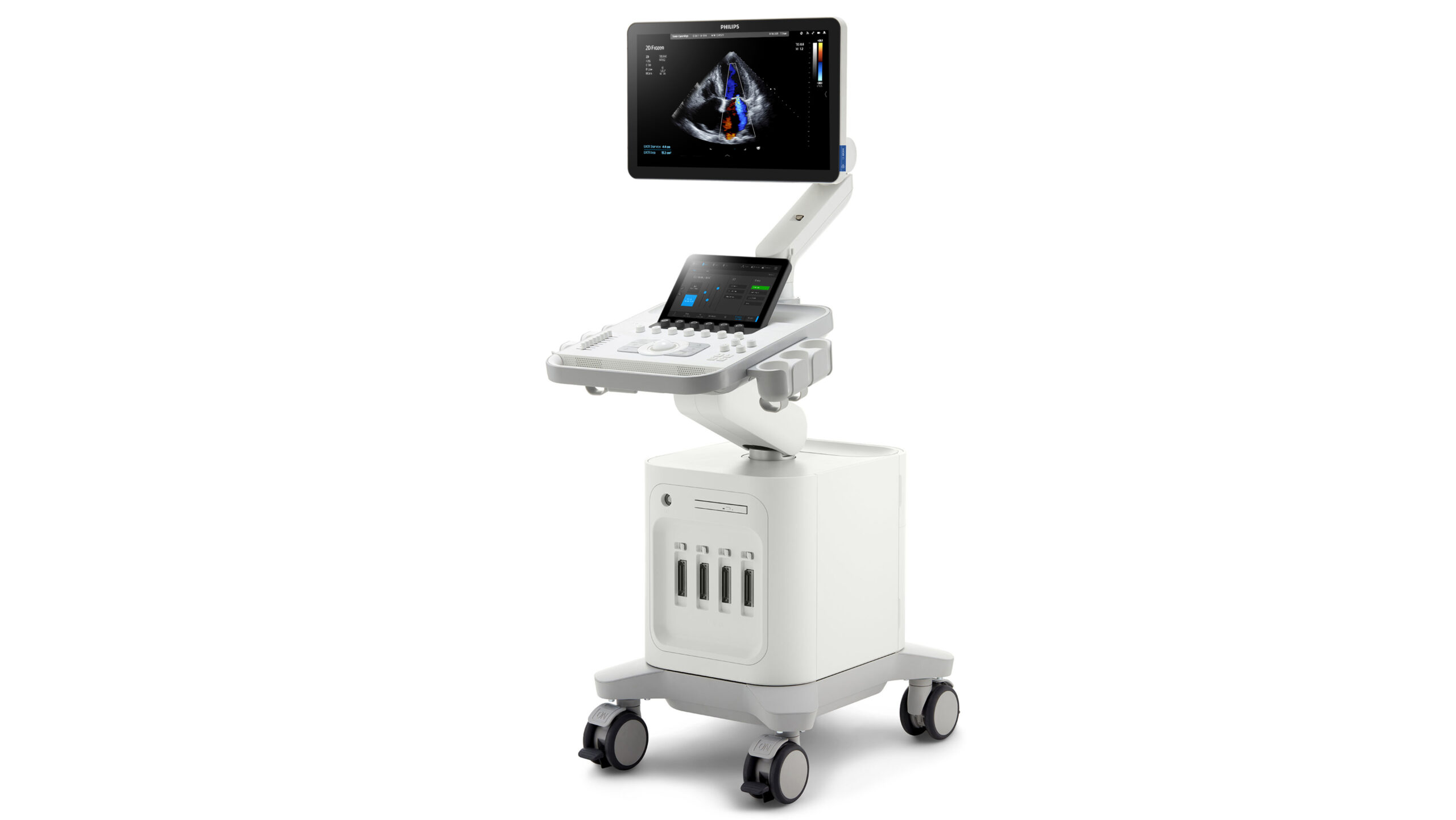 02_PHILIPS_Ultrasound2_16X9